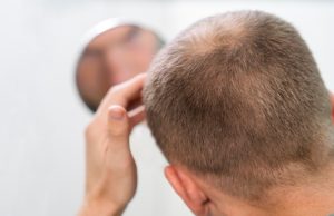 علت ترک و شیار پس از کاشت مو چیست؟