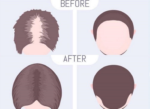 راههای تقویت موهای آقایان و خانم ها