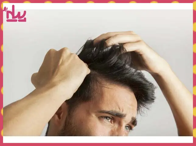 علت خارش سر بعد از کاشت مو و نحوه درمان و جلوگیری
