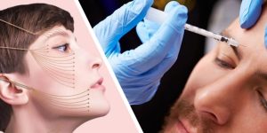 لیفت شقیقه با نخ یا بوتاکس؟ بهترین روش برای شما کدام است؟