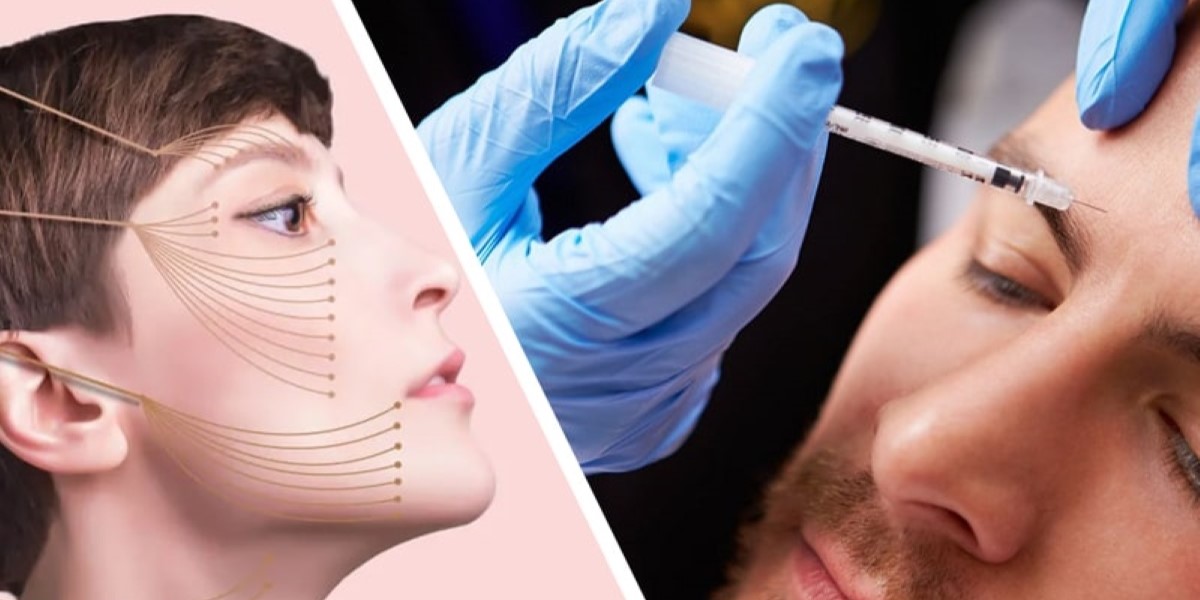لیفت شقیقه با نخ یا بوتاکس؟ بهترین روش برای شما کدام است؟